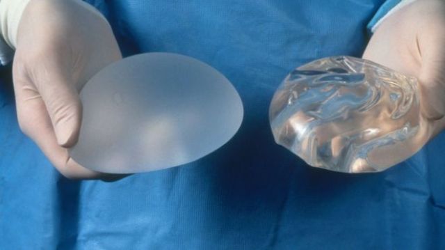 breast-implant-cancer-fake-breasts